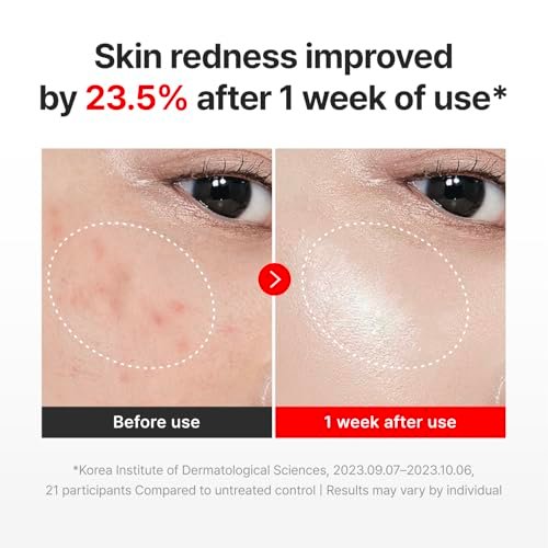 CENTELLIAN 24 Madeca Cream Time Reverse & Active Renew PDRN Duo (2 x 1.69 fl oz) – Firming, Wrinkle Care, Elasticity & Hydration with Centella, TECA PDRN & Hyaluronic Acid, Korean Moisturizer Avelisse