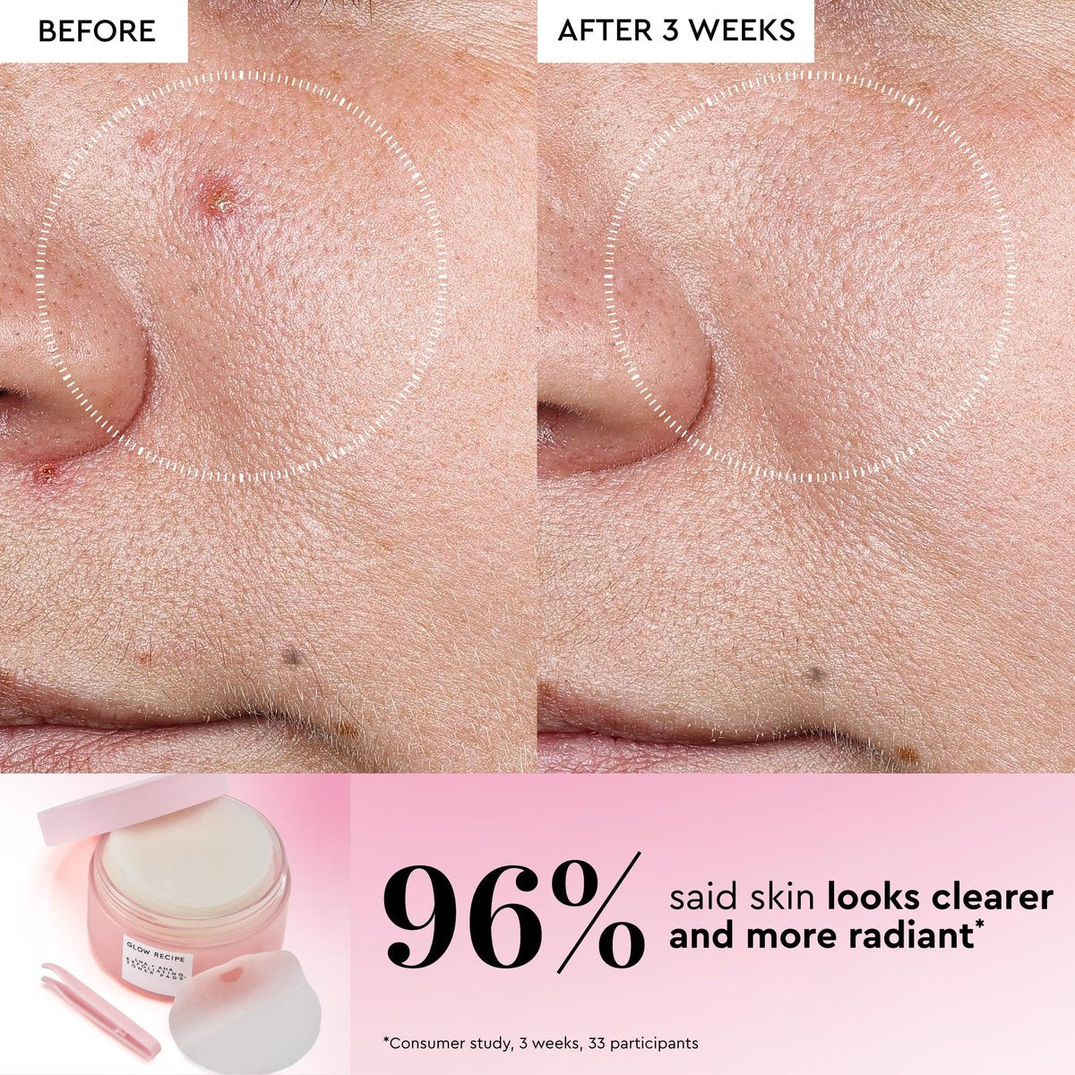Glow Recipe LHA + AHA Exfoliating Toner Pads – Korean Pore Minimizer & Hydrating Toner with 5 Gentle Acids, Watermelon Enzymes, and Botanicals (60 Pads) Avelisse