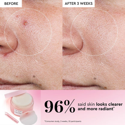 Glow Recipe LHA + AHA Exfoliating Toner Pads – Korean Pore Minimizer & Hydrating Toner with 5 Gentle Acids, Watermelon Enzymes, and Botanicals (60 Pads) Avelisse