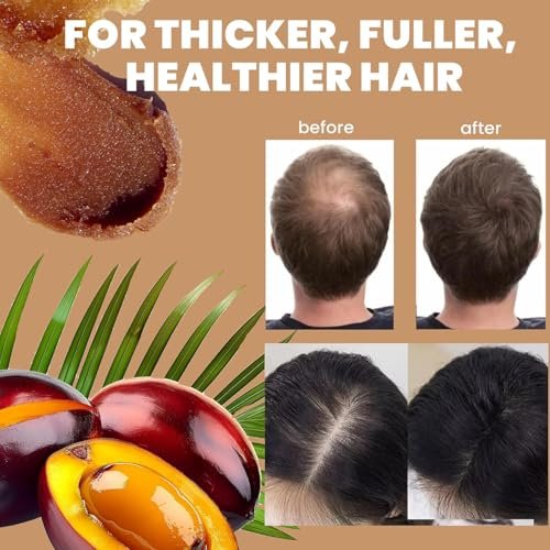 Batana Natural Hair Oil – Raw & Unrefined for Hair Growth, Prevents Hair Loss & Boosts Thickness for Men & Women (4.2 Fl Oz) Avelisse