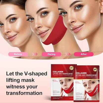 Redcool V Line Lifting Collagen Mask for Double Chin & Jawline Care - 5 Pack Avelisse