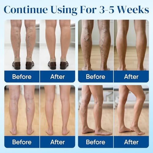 2Box Vein Target Microdarts Patch - Varicose Veins Treatment for Legs, Improves Blood Circulation, Natural Ingredients, 2 Patches Avelisse