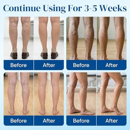 2Box Vein Target Microdarts Patch - Varicose Veins Treatment for Legs, Improves Blood Circulation, Natural Ingredients, 2 Patches Avelisse