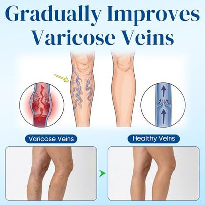 Vein Target Microdarts Patch - Professional Varicose Veins for Legs Patch with Natural Ingredients, 2 Pack Avelisse
