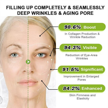 FILWY Botoxmix & Vita-A Retinol Shot Wrinkle-Lift Tightening Cream – Advanced Retinol Body Lotion, Natural Anti-Wrinkle Cream, Pore Minimizer for All Skin Types (2-Pack) Avelisse