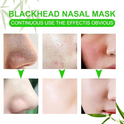Ruduwu Natural Charcoal Pore Strips for Blackheads - 80 Count Nose Strips for All Skin Types - görsel 10