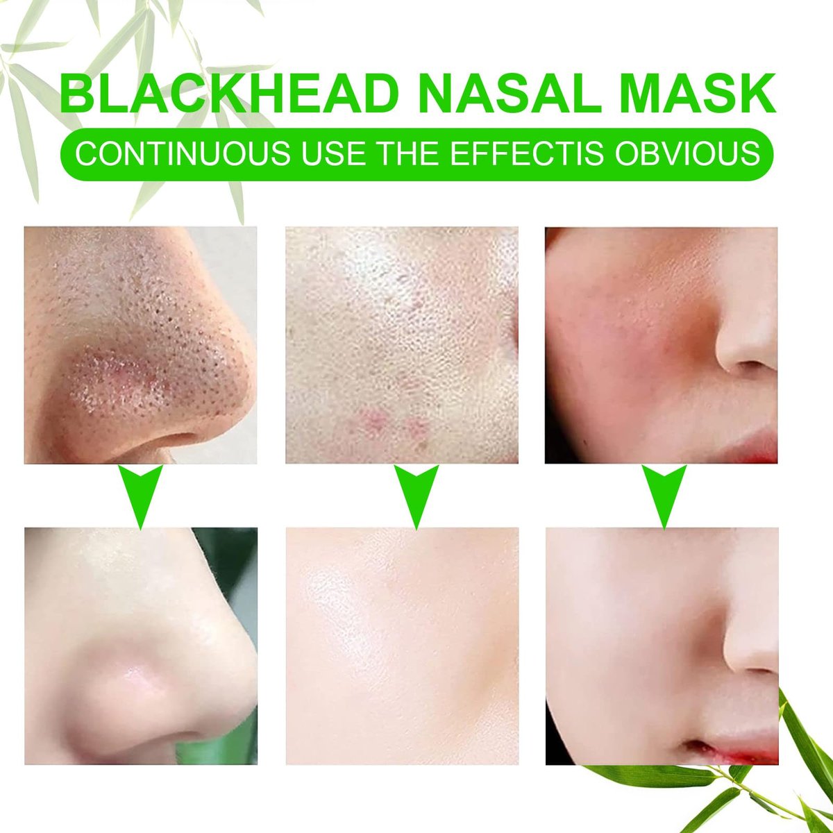 Ruduwu Natural Charcoal Pore Strips for Blackheads - 80 Count Nose Strips for All Skin Types - görsel 9
