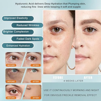 Total Facial Serum with Vitamin C, Hyaluronic Acid & Peptides – Anti-Aging & Hydrating Face Pump Serum for Women, 1 Fl Oz Avelisse