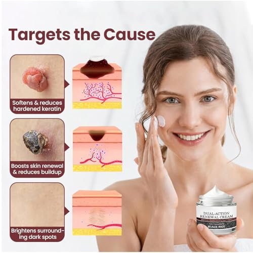 HTKINMI Dual-Action Renewal Cream with Black and White Rice - Soothing Repair Cream for All Skin Types (1 Fl Oz) - görsel 10