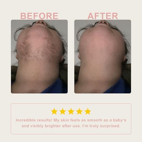 Flawless Facial Hair Removal Cream for Women – Sensitive Skin Depilatory, 1.69 Fl Oz Avelisse