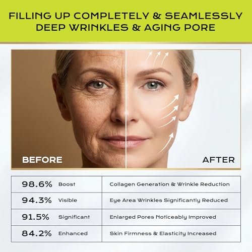 Botoxmix & Vita-A Retinol Shot Wrinkle-Lift Tightening Cream – High-Strength Retinoid Anti-Aging Cream with Natural Pore Minimizer (2-Pack, 0.5 oz Each) Avelisse