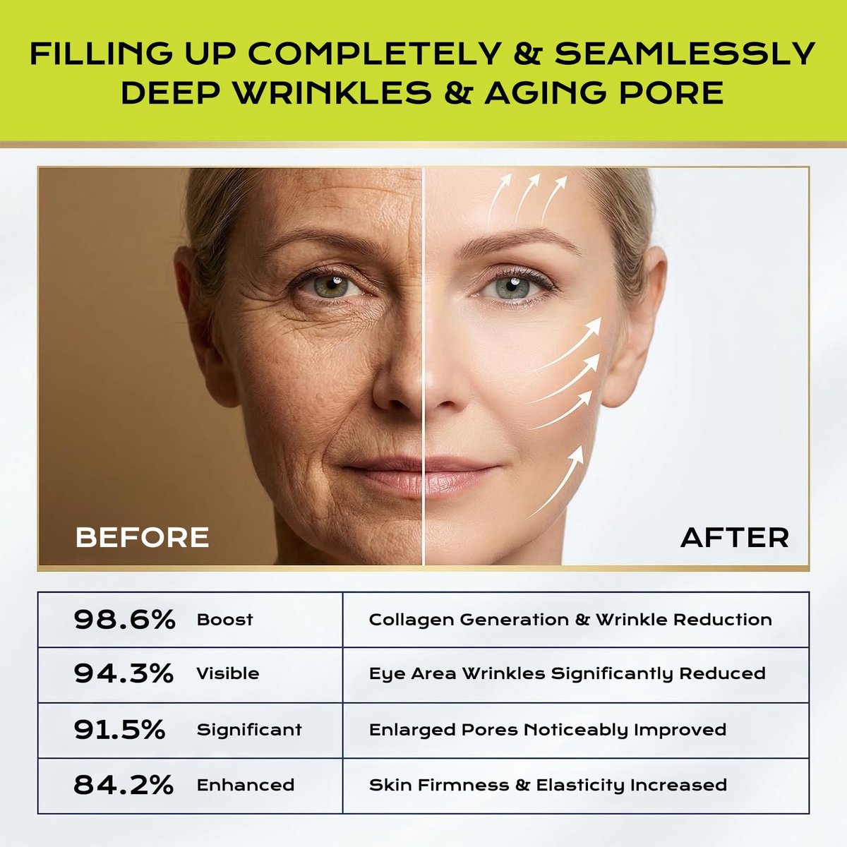 Botoxmix & Vita-A Retinol Shot Wrinkle-Lift Tightening Cream – High-Strength Retinoid Anti-Aging Cream with Natural Pore Minimizer (2-Pack, 0.5 oz Each) Avelisse