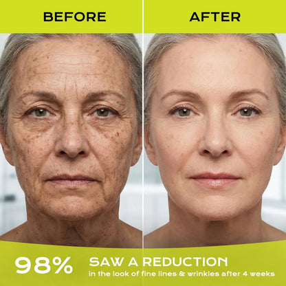 Botoxmix & Vita-A Retinol Shot Wrinkle-Lift Tightening Cream – High-Strength Retinoid Anti-Aging Cream with Natural Pore Minimizer (2-Pack, 0.5 oz Each) Avelisse