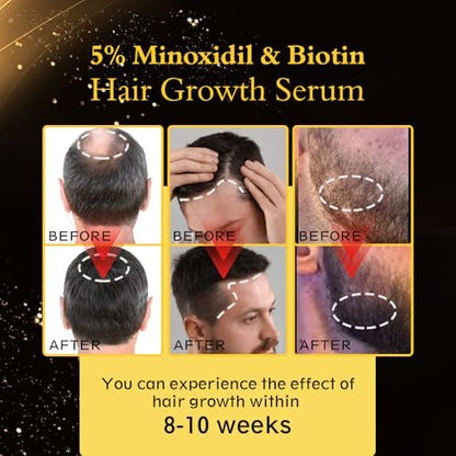 5% Minoxidil Hair Regrowth Oil for Men and Women – Extra Strength Topical Serum for Hair Loss, Promotes Thicker, Healthier Hair and Beard Growth Kit, 2.11 fl.oz (Pack of 2) Avelisse