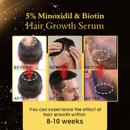 5% Minoxidil Hair Regrowth Oil for Men and Women – Extra Strength Topical Serum for Hair Loss, Promotes Thicker, Healthier Hair and Beard Growth Kit, 2.11 fl.oz (Pack of 2) Avelisse