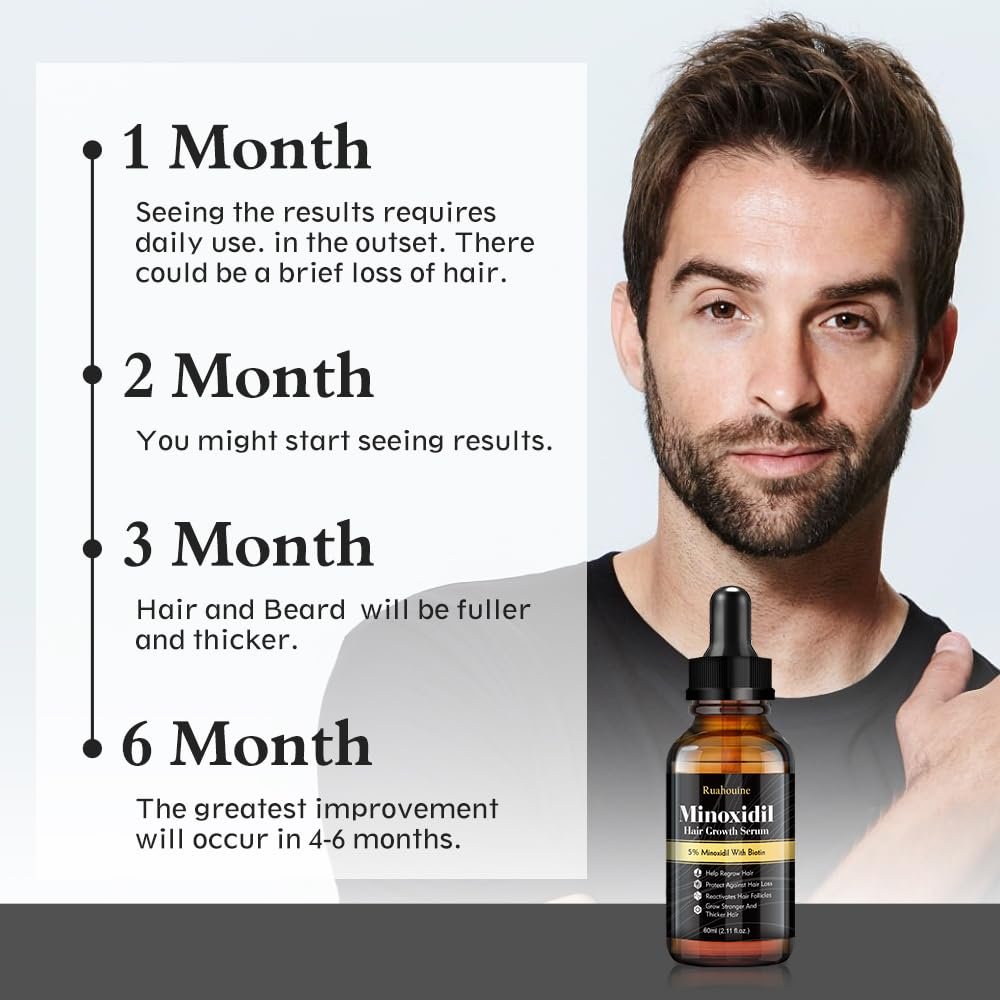 5% Minoxidil Hair Regrowth Oil for Men and Women – Extra Strength Topical Serum for Hair Loss, Promotes Thicker, Healthier Hair and Beard Growth Kit, 2.11 fl.oz (Pack of 2) Avelisse