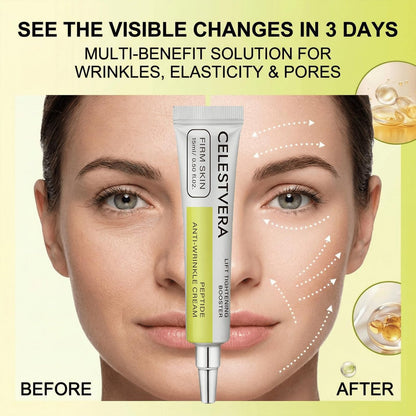 Celestvera Retinol Shot Wrinkle-Lift Tightening Cream – 0.1% Retinal + 3% Matryxyl High Potency Retinoid Serum for Face, Supports Skin Elasticity & Pore Clarity (1 Fl Oz) Avelisse