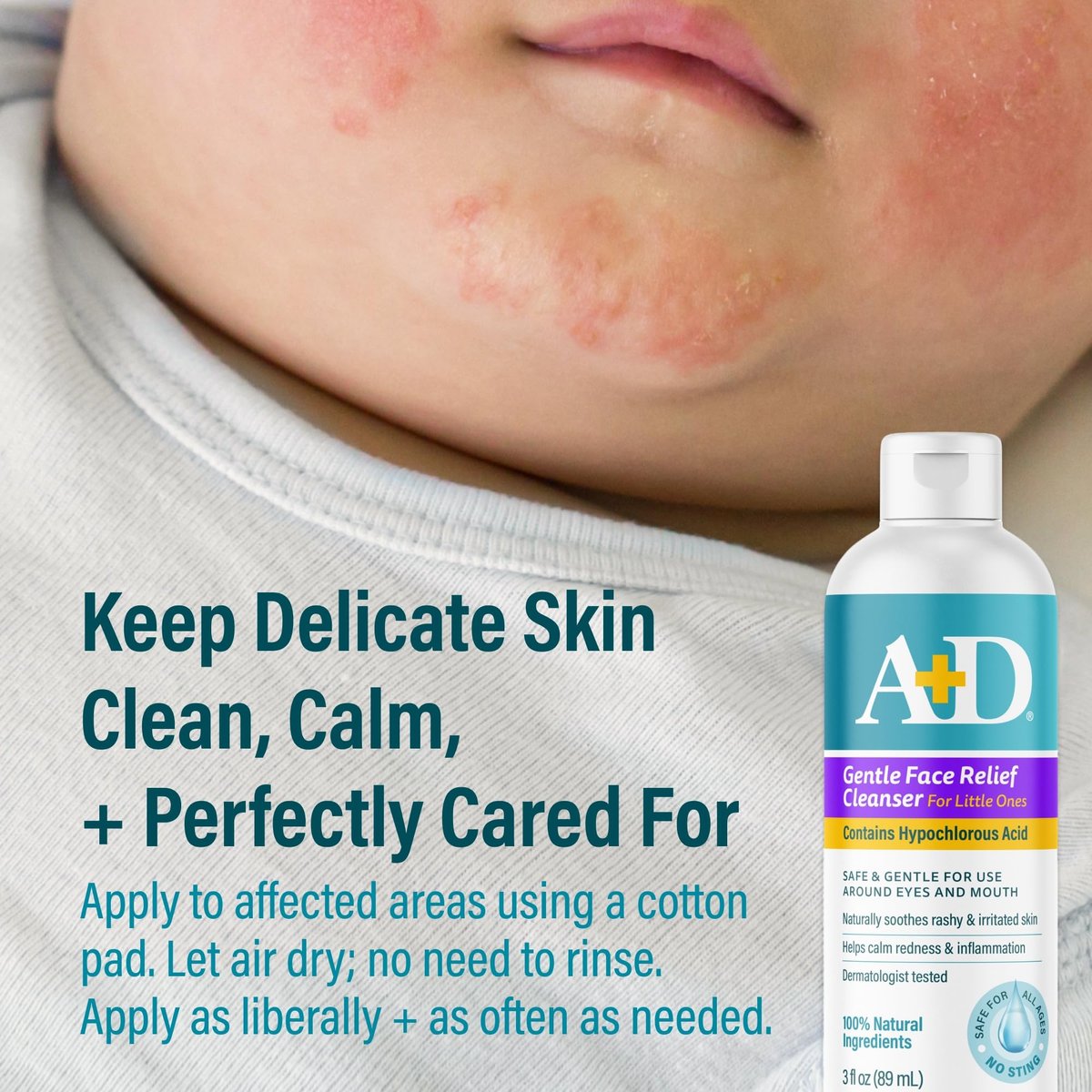 A+D Gentle Face Relief Cleanser for Little Ones with Hypochlorous Acid - 3 oz, 100% Natural, Non-Toxic, Sting-Free, Safe Around Eyes & Mouth - görsel 9