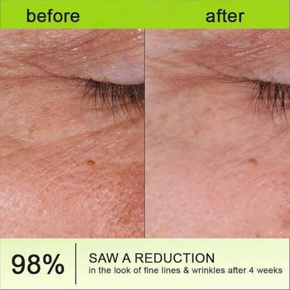 2 Pack Botoxmix & Vita-A Retinol Shot Wrinkle-Lift Tightening Cream – Anti-Wrinkle & Pore Minimizer for All Skin Types