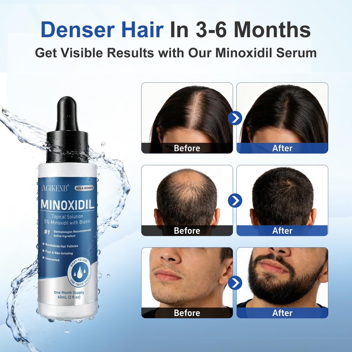8 Pack 5% Minoxidil Hair Regrowth Treatment for Men and Women – Topical Solution for Hair Loss, Thinning Hair, Receding Hairline & Bald Spots – Supports Beard & Scalp Growth (8 Month Supply) Avelisse