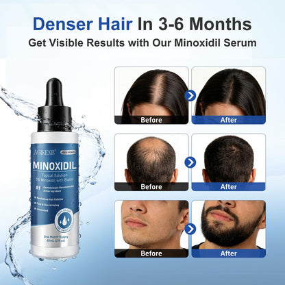 8 Pack 5% Minoxidil Hair Regrowth Treatment for Men and Women – Topical Solution for Hair Loss, Thinning Hair, Receding Hairline & Bald Spots – Supports Beard & Scalp Growth (8 Month Supply) Avelisse