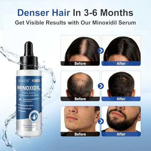 8 Pack 5% Minoxidil Hair Regrowth Treatment for Men and Women – Topical Solution for Hair Loss, Thinning Hair, Receding Hairline & Bald Spots – Supports Beard & Scalp Growth (8 Month Supply) Avelisse
