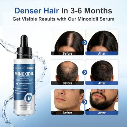 8 Pack 5% Minoxidil Hair Regrowth Treatment for Men and Women – Topical Solution for Hair Loss, Thinning Hair, Receding Hairline & Bald Spots – Supports Beard & Scalp Growth (8 Month Supply) Avelisse