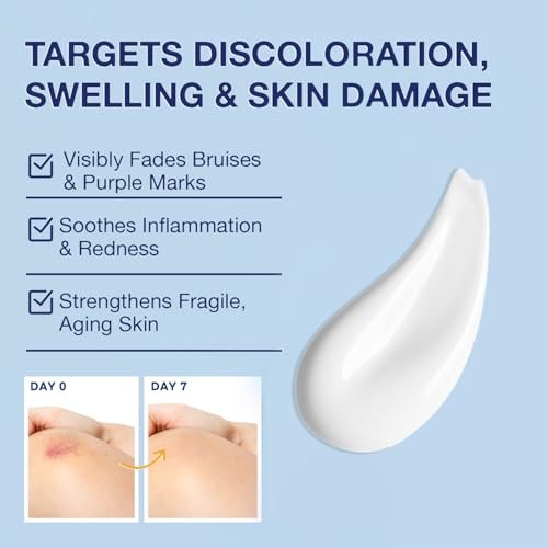 PHARMBANNER Arnica Bruise Cream Extra Strength – Fast-Acting Arnica Montana with Vitamins K, C & E for Bruising, Swelling, Discoloration & Thin Skin – Hydrating Moisturizer for Face & Body – 4 oz Avelisse