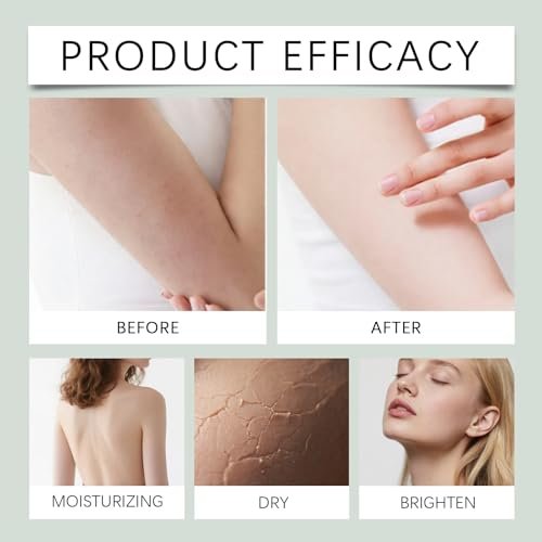 Intertrigo Cream for Treatment & Relief, Advanced Chafing Cream with Zinc Oxide & Undecylenic Acid – Non-Greasy Skin Protectant for Inner Thighs, Underarms, Skin Folds – Moisture Control, 2 Oz - görsel 6