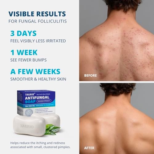 TAGRID Tea Tree Oatmeal Antifungal Soap for Sweaty Skin – Post-Workout Body Cleanser for Active Lifestyles & Gym, Gentle Daily Skin Care, 2-Pack Avelisse