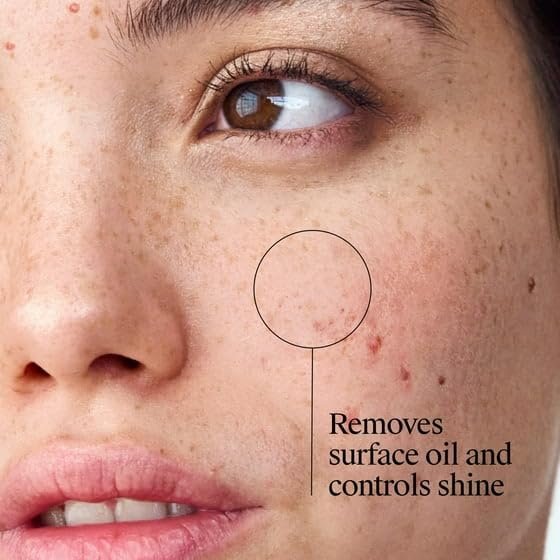 Oil Eliminating Acne Treatment Astringent Toner with Salicylic Acid – Pore Cleanser for Clear Skin, 8 oz Avelisse