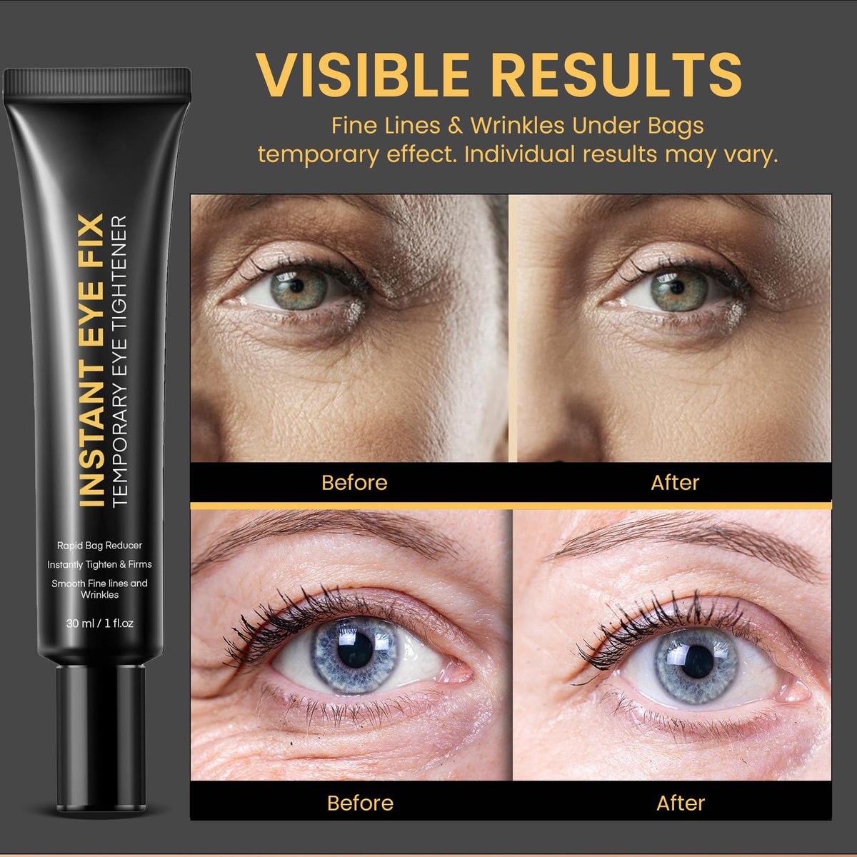 Foffreo Temporary Instant Under Eye Tightener - Reduces Bags, Dark Circles, Puffiness & Wrinkles - Advanced Firming Polysaccharide Formula 30 ml Avelisse