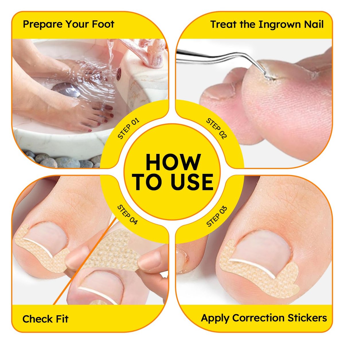 Ingrown Toenail Treatment Kit - Breathable Curved Toenail Corrector Strips with File and Lifter, 60 Pcs for Pain Relief - görsel 7