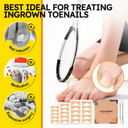 Ingrown Toenail Treatment Kit - Breathable Curved Toenail Corrector Strips with File and Lifter, 60 Pcs for Pain Relief
