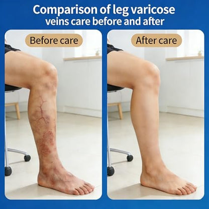 Vein Ease Microdarts Care Patch - 2 Boxes Professional Varicose Veins Treatment for Legs, Natural Ingredients, Improves Blood Circulation, Suitable for All Skin Types Avelisse