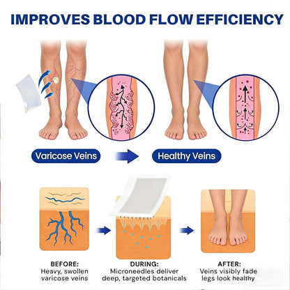 Vein Ease Microdarts Care Patch - 2 Boxes Professional Varicose Veins Treatment for Legs, Natural Ingredients, Improves Blood Circulation, Suitable for All Skin Types Avelisse
