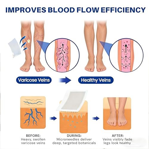 Vein Ease Microdarts Care Patch - 2 Boxes Professional Varicose Veins Treatment for Legs, Natural Ingredients, Improves Blood Circulation, Suitable for All Skin Types Avelisse