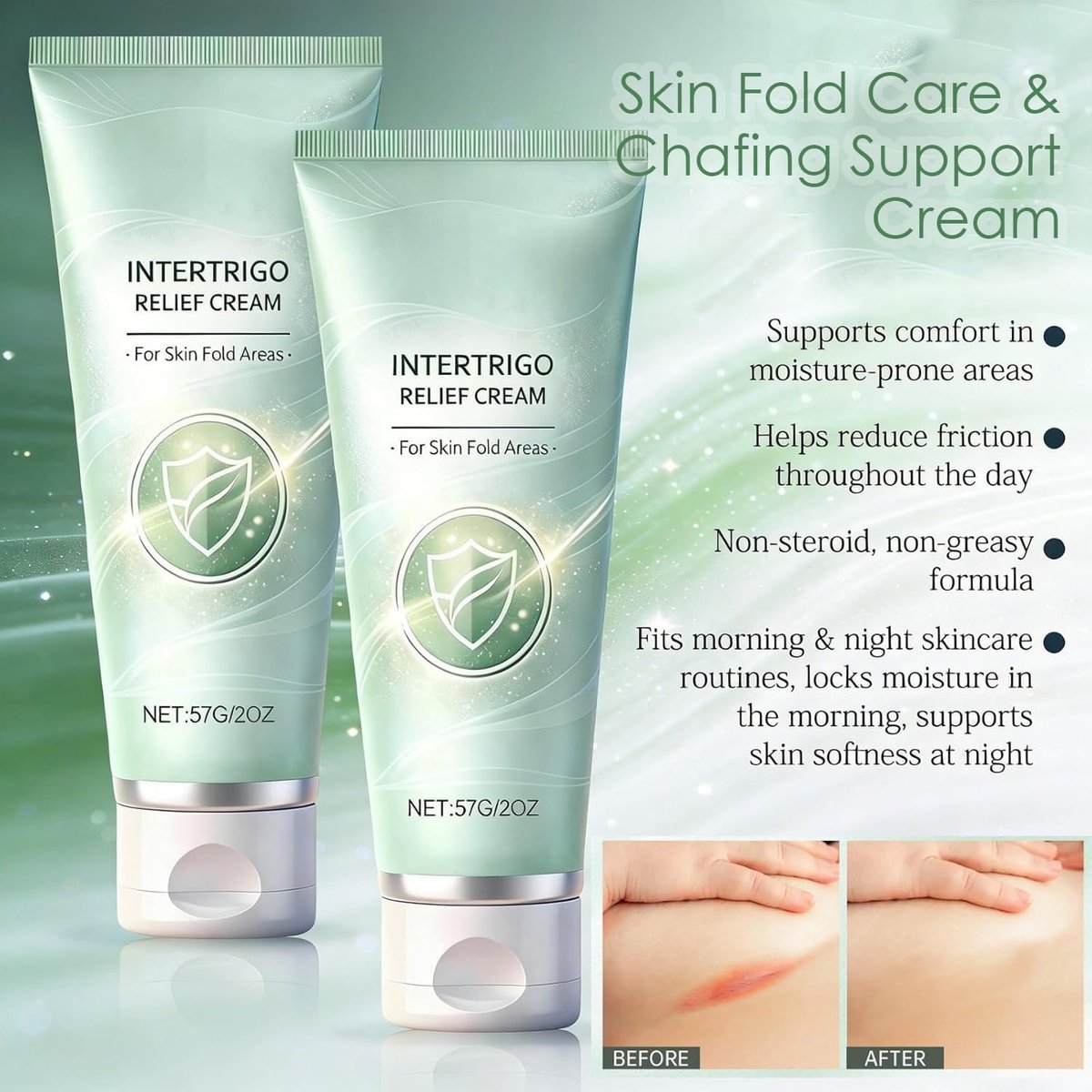 2-Pack Intertrigo Cream: Skin Fold Care & Chafing Support with Moisture Barrier, Fast-Drying Formula for Friction-Prone Areas, Soothes Irritated Skin & Reduces Friction Protection - 1 Fl Oz Each Avelisse