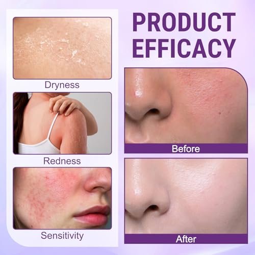 2-Pack Biotin 10-in-1 Skin Restoration Cream – 2026 Professional Wrinkle Reducer & Repair Moisturizer for All Skin Types - görsel 7