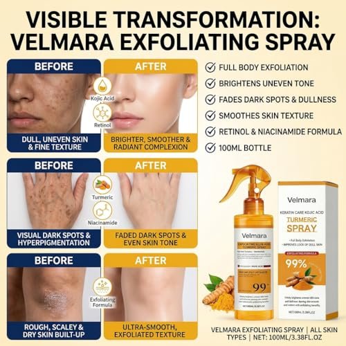 Exfoliating Turmeric Spray with Keratin Care Acid - 2026 New Korean Skincare Peeling Solution for All Skin Types (6-Pack) Avelisse