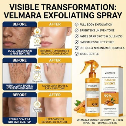 Exfoliating Turmeric Spray with Keratin Care Acid - 2026 New Korean Skincare Peeling Solution for All Skin Types (6-Pack) Avelisse