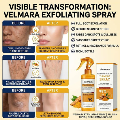Exfoliating Turmeric Spray with Keratin Care Acid - 2026 New Korean Skincare Peeling Solution for All Skin Types (6-Pack) Avelisse
