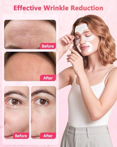 Vryioh 3-IN-1 Forehead, Smile Line & Under Eye Wrinkle Patches – Overnight Treatment with Hyaluronic Acid & Collagen, 60 Patches Avelisse