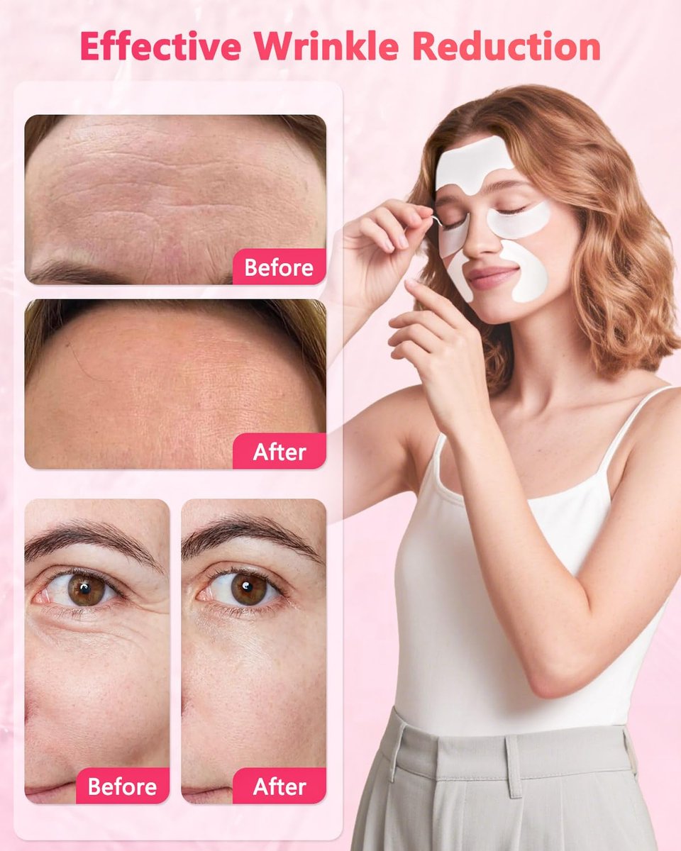 Vryioh 3-IN-1 Forehead, Smile Line & Under Eye Wrinkle Patches – Overnight Treatment with Hyaluronic Acid & Collagen, 60 Patches Avelisse