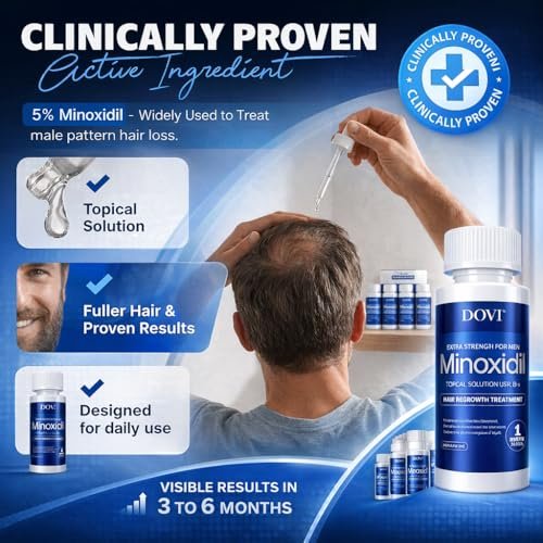 Dovi Minoxidil 5% Hair Regrowth Treatment for Men – Extra Strength Advanced Topical Solution, 6 Month Supply Avelisse