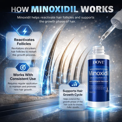 Dovi Minoxidil 5% Hair Regrowth Treatment for Men – Extra Strength Advanced Topical Solution, 6 Month Supply Avelisse