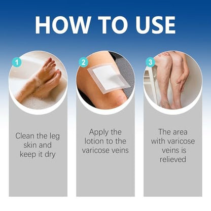 VeinTarget Microdarts Patch – Professional Varicose Veins Treatment for Legs, Natural Ingredients, All Skin Types (1 Pack) Avelisse