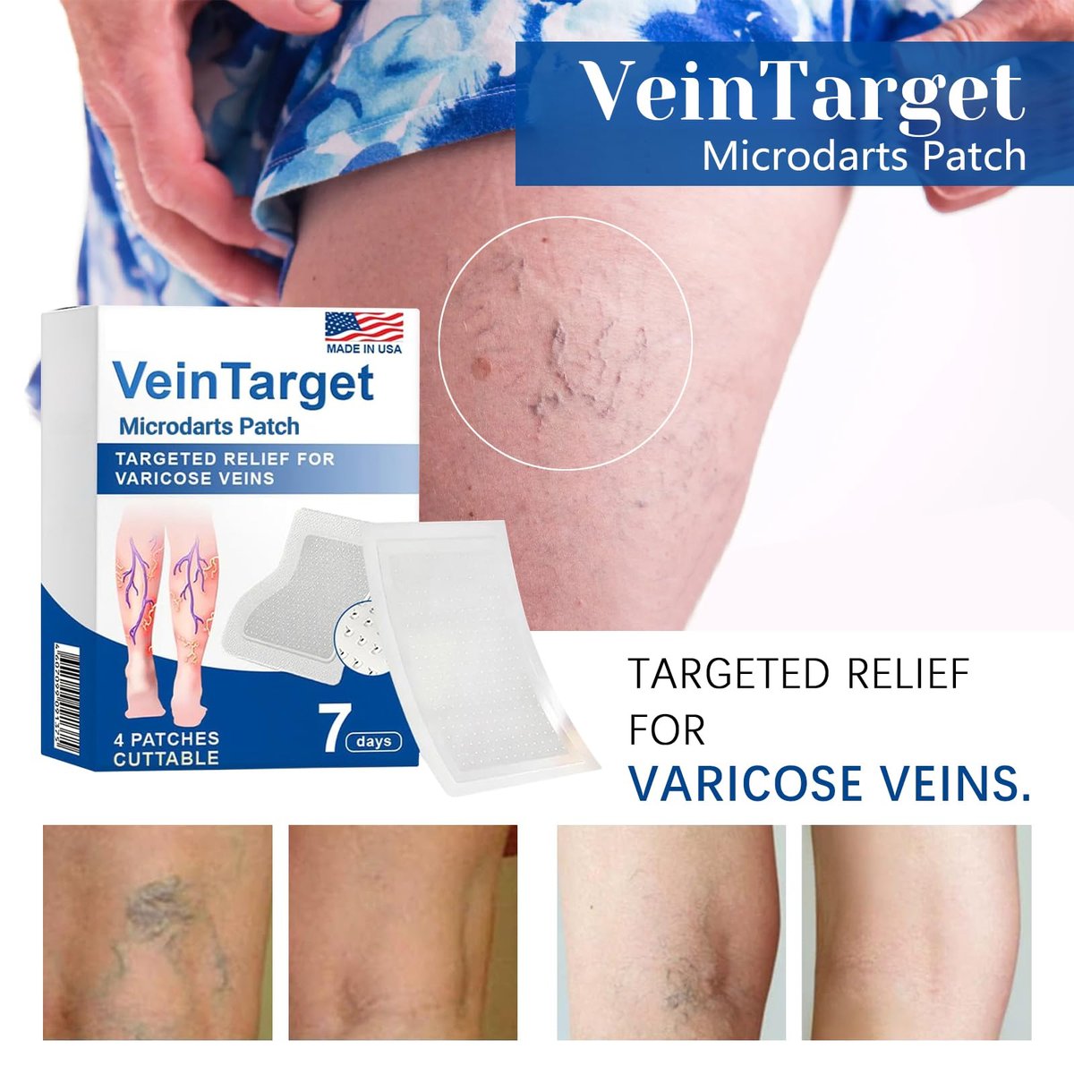 VeinTarget Microdarts Patch – Professional Varicose Veins Treatment for Legs, Natural Ingredients, All Skin Types (1 Pack) Avelisse