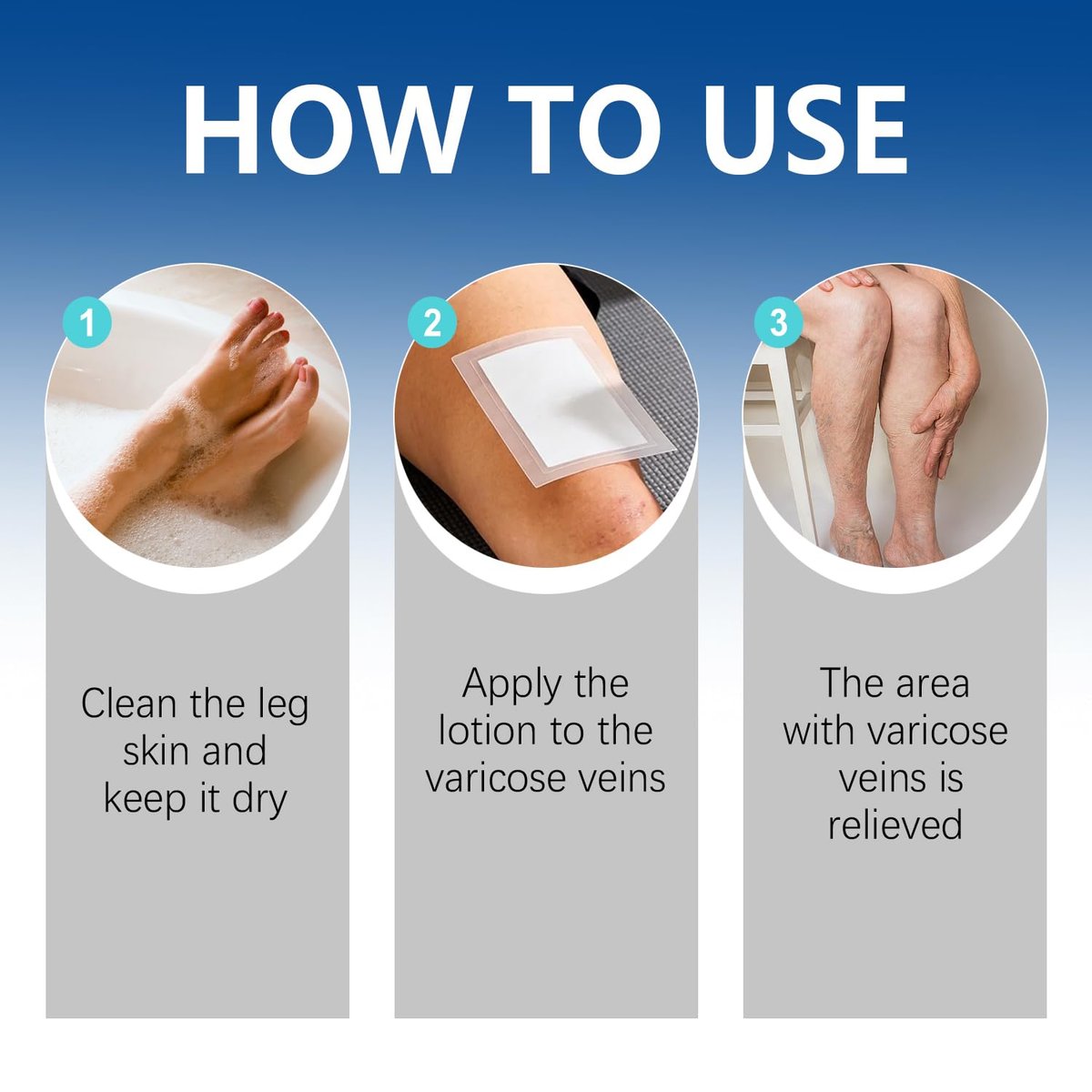 VeinTarget Microdarts Patch – Professional Varicose Veins Treatment for Legs, Natural Ingredients, All Skin Types (1 Pack) Avelisse