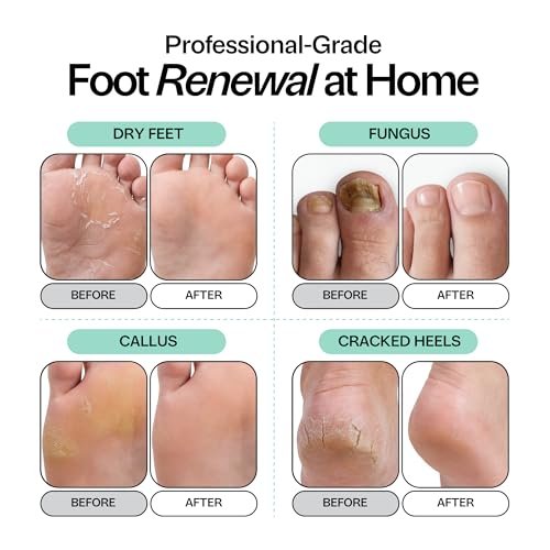 Foot Choice Tea Tree Oil Foot Soak with Epsom Salt - Toenail Repair, Odor Elimination & Callus Softening - Soothes Tired, Sore Feet & Itchy Skin - Made in USA, 16 oz - görsel 6